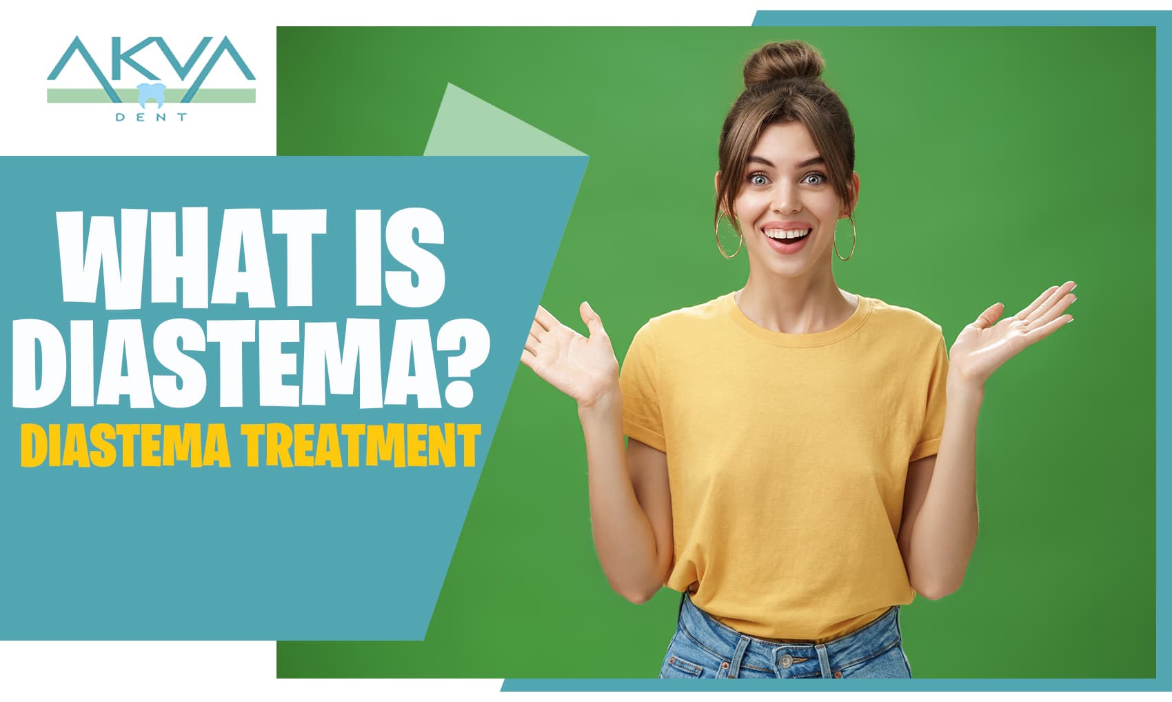 Diastema-Treatment